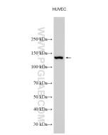 eNOS Polyclonal antibody proteintech 27120-1-AP