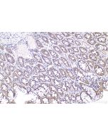 MGP Polyclonal antibody proteintech 10734-1-AP