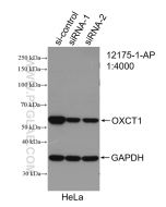 OXCT1 Polyclonal antibody proteintech 12175-1-AP