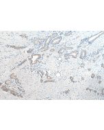 CD47 Polyclonal antibody proteintech 20305-1-AP