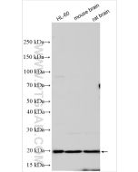 RAC1 Polyclonal antibody proteintech 24072-1-AP