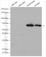 Dopamine Transporter/DAT Polyclonal antibody proteintech 22524-1-AP