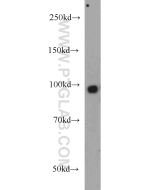 SYNPO Polyclonal antibody proteintech 21064-1-AP