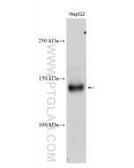 c-Met (Cytoplasmic) Polyclonal antibody proteintech 25869-1-AP
