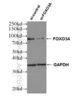 FOXO3A Polyclonal antibody proteintech 10849-1-AP