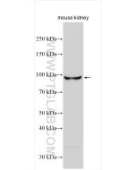 NR3C2 Polyclonal antibody proteintech 21854-1-AP