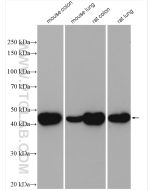 Alpha smooth muscle actin specific Polyclonal antibody proteintech 55135-1-AP