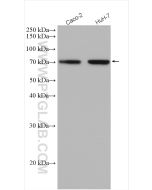 DMT1 Polyclonal antibody proteintech 20507-1-AP