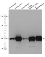 ACTN2 Polyclonal antibody proteintech 14221-1-AP