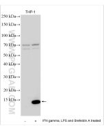 CXCL10/IP-10 Polyclonal antibody proteintech 10937-1-AP