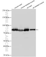 Aconitase 2 Polyclonal antibody proteintech 11134-1-AP