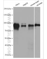 Glucocorticoid receptor Polyclonal antibody proteintech 24050-1-AP