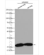 Claudin 5 Polyclonal antibody proteintech 29767-1-AP