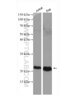 CD81 Polyclonal antibody proteintech 27855-1-AP