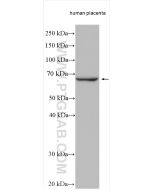 GBP1 Polyclonal antibody proteintech 15303-1-AP
