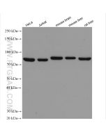 AFG3L2 Polyclonal antibody proteintech 14631-1-AP