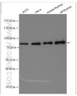 MCM5 Polyclonal antibody proteintech 11703-1-AP