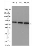 uPA/Urokinase Polyclonal antibody proteintech 17968-1-AP