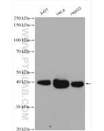 FSTL1 Polyclonal antibody proteintech 20182-1-AP