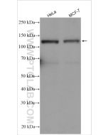 SREBF1 Polyclonal antibody proteintech 14088-1-AP