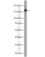 EGFR (C-terminal) Polyclonal antibody proteintech 51071-2-AP