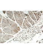 Osteocalcin Polyclonal antibody proteintech 20277-1-AP