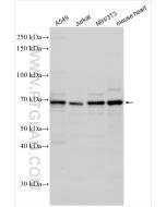 MITF Polyclonal antibody proteintech 13092-1-AP