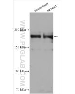 MYH6 Polyclonal antibody proteintech 22281-1-AP