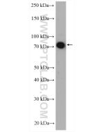 TAK1 Polyclonal antibody proteintech 12330-2-AP