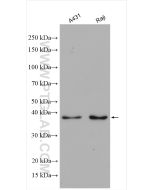 AIM2 Polyclonal antibody proteintech 20590-1-AP