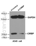 CIRBP Polyclonal antibody proteintech 10209-2-AP