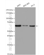 P4HA1 Polyclonal antibody proteintech 12658-1-AP