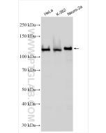 Drebrin Polyclonal antibody proteintech 10260-1-AP
