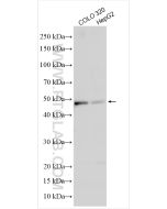 Biglycan Polyclonal antibody proteintech 16409-1-AP