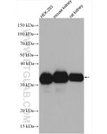 LDHA Polyclonal antibody proteintech 21799-1-AP