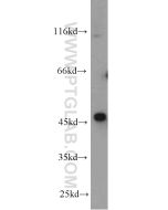 OXTR Polyclonal antibody proteintech 23045-1-AP