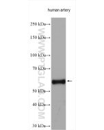 Elastin Polyclonal antibody proteintech 15257-1-AP