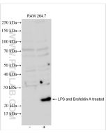 IL-6 Polyclonal antibody proteintech 26404-1-AP