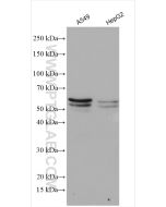 SQLE Polyclonal antibody proteintech 12544-1-AP