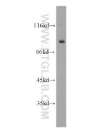 ODF2 Polyclonal antibody proteintech 12058-1-AP