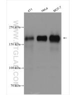 HER2/ErbB2 Polyclonal antibody proteintech 18299-1-AP