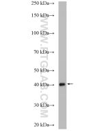BBS5 Polyclonal antibody proteintech 14569-1-AP