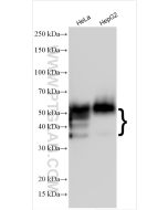 CD147 Polyclonal antibody proteintech 11989-1-AP