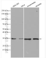 Geminin Polyclonal antibody proteintech 10802-1-AP