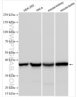 ATP6V0D1 Polyclonal antibody proteintech 18274-1-AP