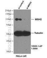 MSH2 Polyclonal antibody proteintech 15520-1-AP