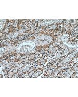 PGF/PIGF Polyclonal antibody proteintech 10642-1-AP