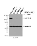 IMPDH2 Polyclonal antibody proteintech 12948-1-AP