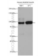 ATP1A1/2/3/4 Polyclonal antibody proteintech 16836-1-AP