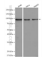 TAX1BP1 Polyclonal antibody proteintech 14424-1-AP